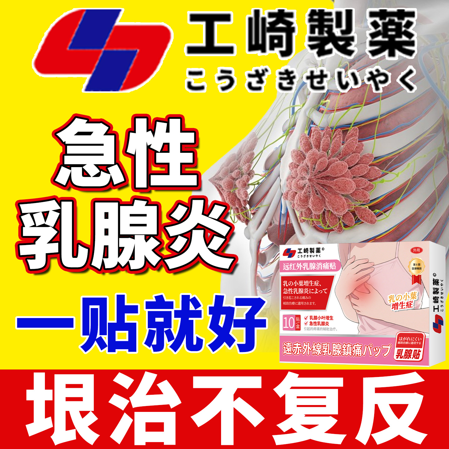 乳腺小叶增生结节散结贴疏通散结硬块乳房胀痛囊肿急性乳腺炎热敷