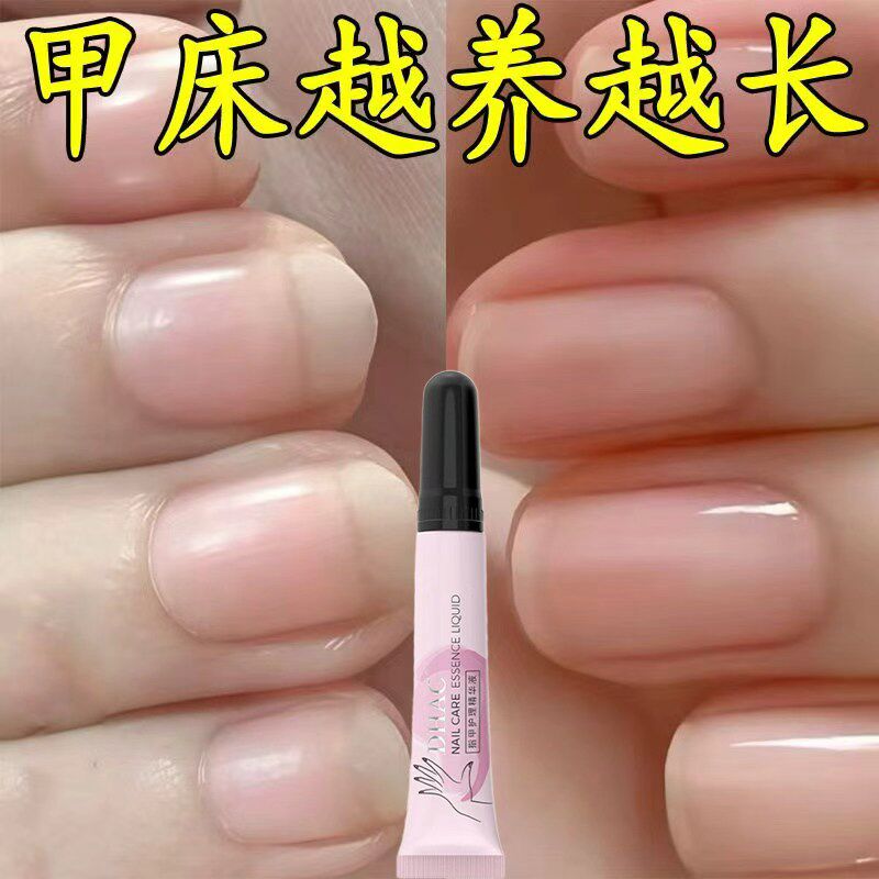 甲床指甲蹭蹭涨防倒刺裂甲起空甲