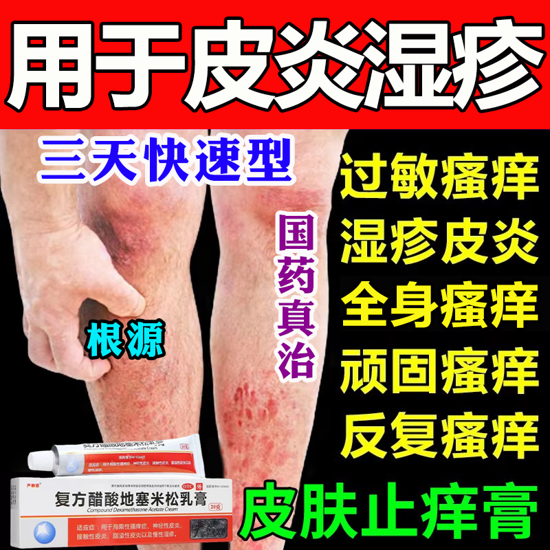 复方醋酸地塞米松乳膏除皮肤湿疹止痒药膏抑