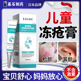 儿童专用耳朵脸部手足消肿止痒预防干裂正品医用级冻疮膏凝胶YZ