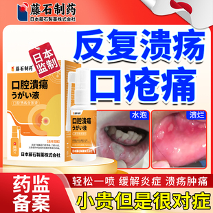 藤石制药口腔溃疡喷雾剂可搭膏药贴一点效特专灵用上火起泡儿童YJ