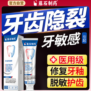 牙隐裂牙齿表面裂纹修复裂缝修补非牙膏液釉质损伤裂痕咬合疼痛YJ