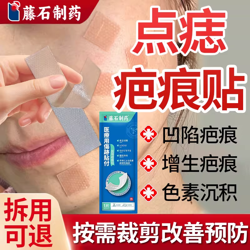 脸上祛痣去痣点痣后无痕疤痕贴修防水贴膏复不留疤疣正品旗舰店SY