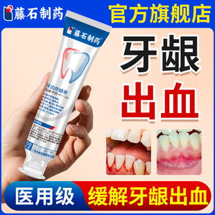 藤石制药牙龈出血凝胶牙周炎牙龈炎敏感牙菌斑可搭牙刷膏漱口水E8