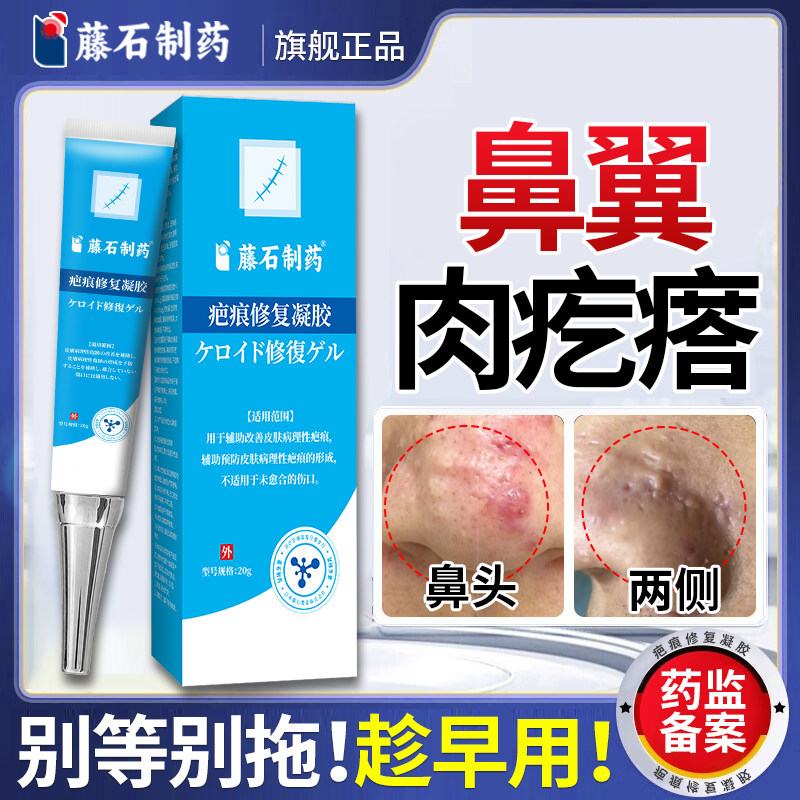 藤石制药鼻子皮脂腺增生鼻翼上小肉疙瘩两边凸起增生疤痕酒槽鼻E8