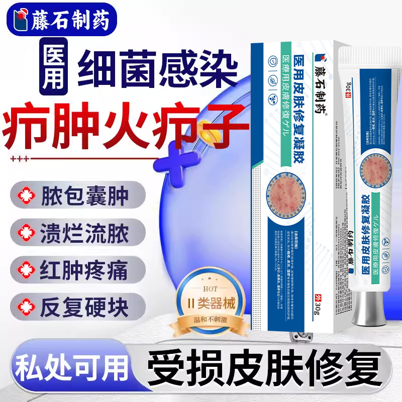 火疖子疖肿搭拔毒拔脓膏包硬块药监备案敷料贴皮脂腺囊肿凝胶E8