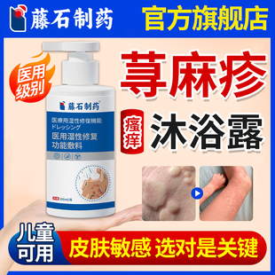藤石制药急慢性寻荨麻疹沐浴露丘疹性过敏儿童搭止痒断膏根喷雾E8