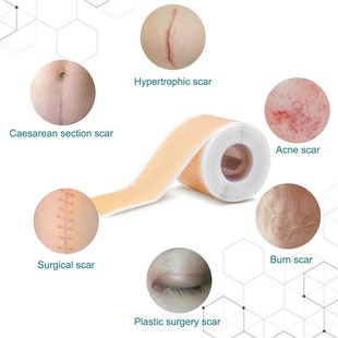 Painless Scar Sheets Siliconqe Repair 4cm Tape 150cm