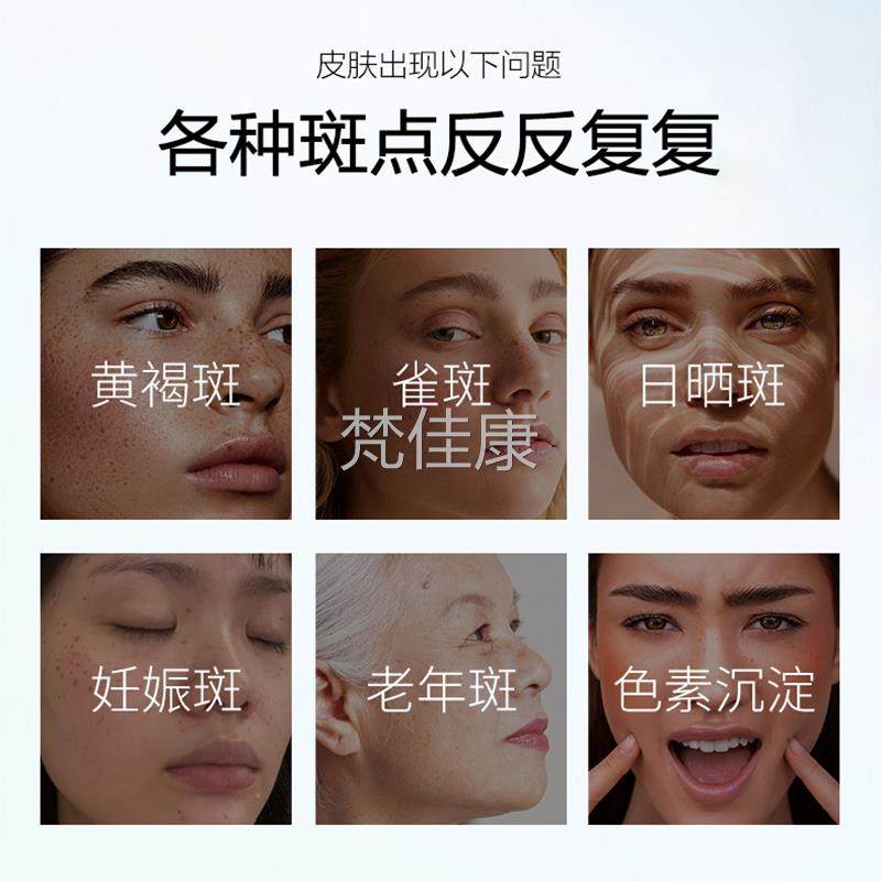 胶氨甲环酸乳软膏凝钾精安用华原液传明酸片医官方HYN面霜祛斑