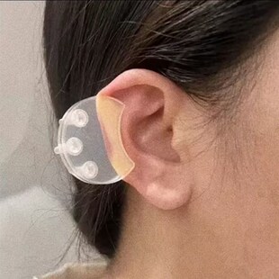 耳朵瘢痕耳夹可调压力式耳垂防止增生夹子透明压克力耳朵压力夹