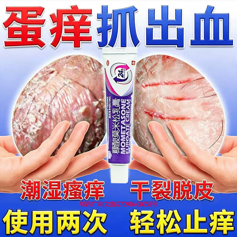 治男性阴囊湿疹瘙痒糠酸莫米松软乳膏私处潮湿特快涂效睾丸止痒正
