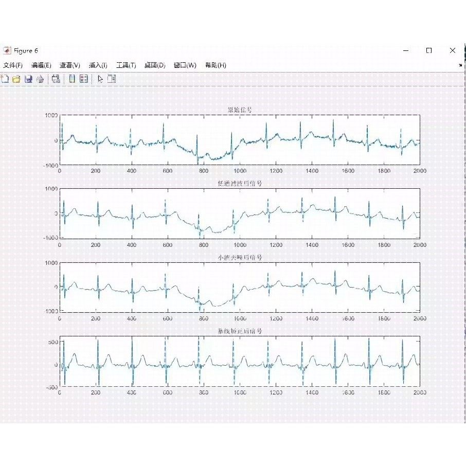 心电信号ECG去噪Matlab程序使用低通滤波和小波分解结合