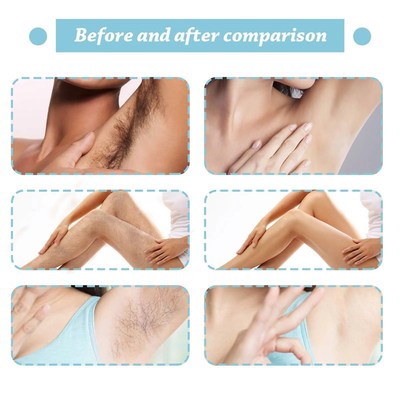 Permanent Hair Removal Spray Painless Hair RPemover for Ladi