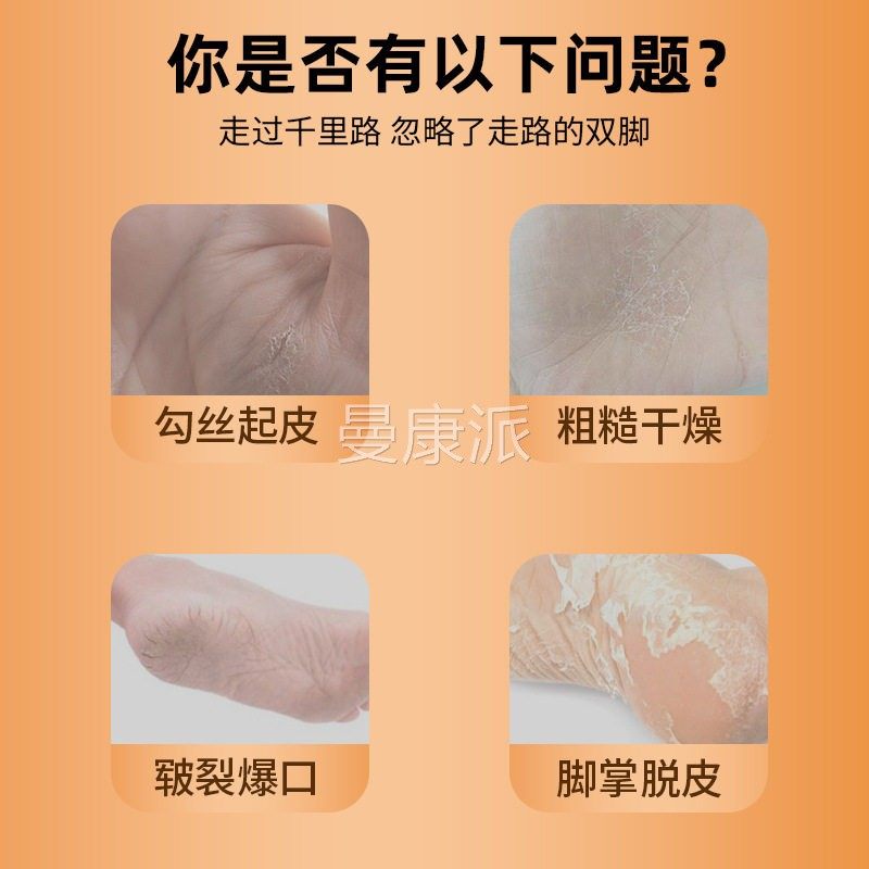 手足乳脱CSQ皮膏皮干裂干脱皮燥起皮护肤理滋润抑菌膏,保健用品,皮肤消毒护理（消）,淘宝优惠券,粉丝福利购,淘宝优惠卷