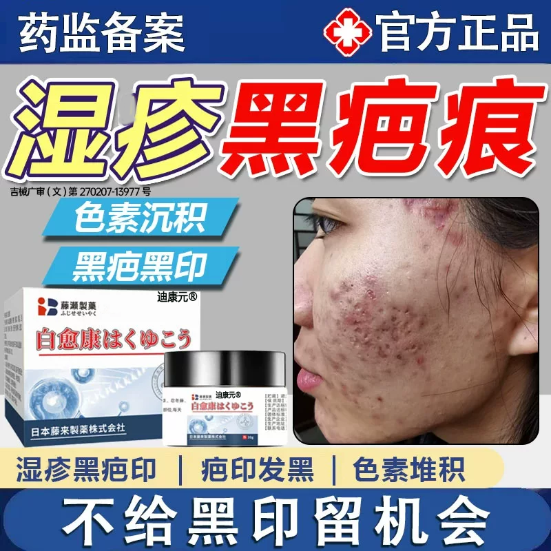 湿疤疹痕黑色素沉淀淡黑印淡化祛疤膏腿上脸后背痘印黑棘皮乳膏FY - 实物图