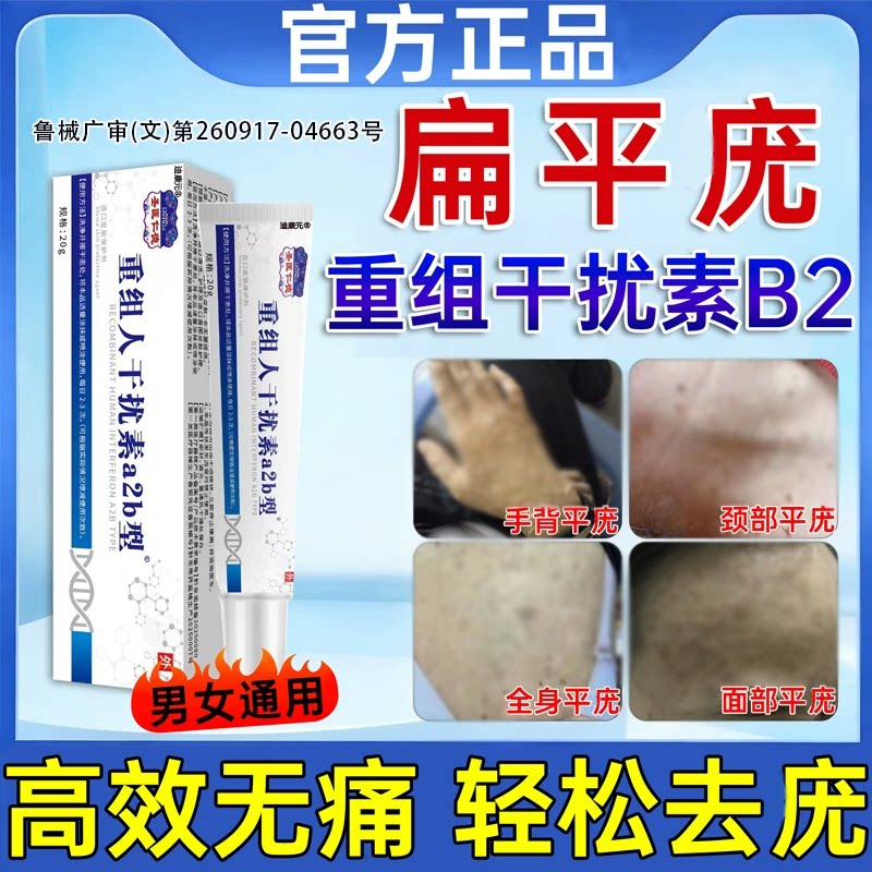 【药房直售】尖锐湿优扁平优脱落