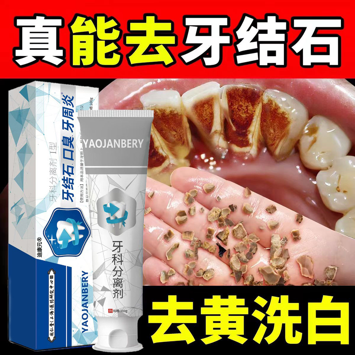去除牙结石口臭烟渍洁白牙齿膏
