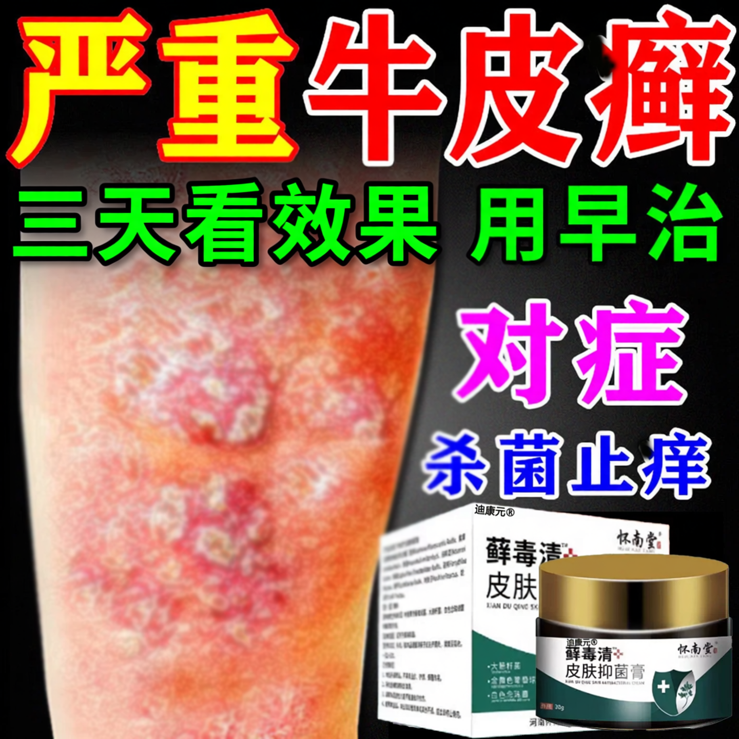 藓毒清膏皮肤抑菌液牛皮手足银头皮屑癣全身皮肤外用止痒膏正品