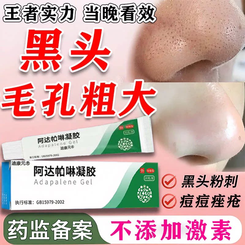 【药房直售】啊达帕琳凝胶去黑头