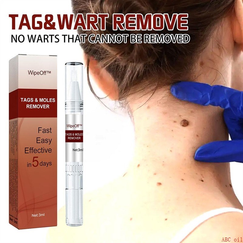 Skin face body Tags Moles Remover liquid WOart Treatment pen