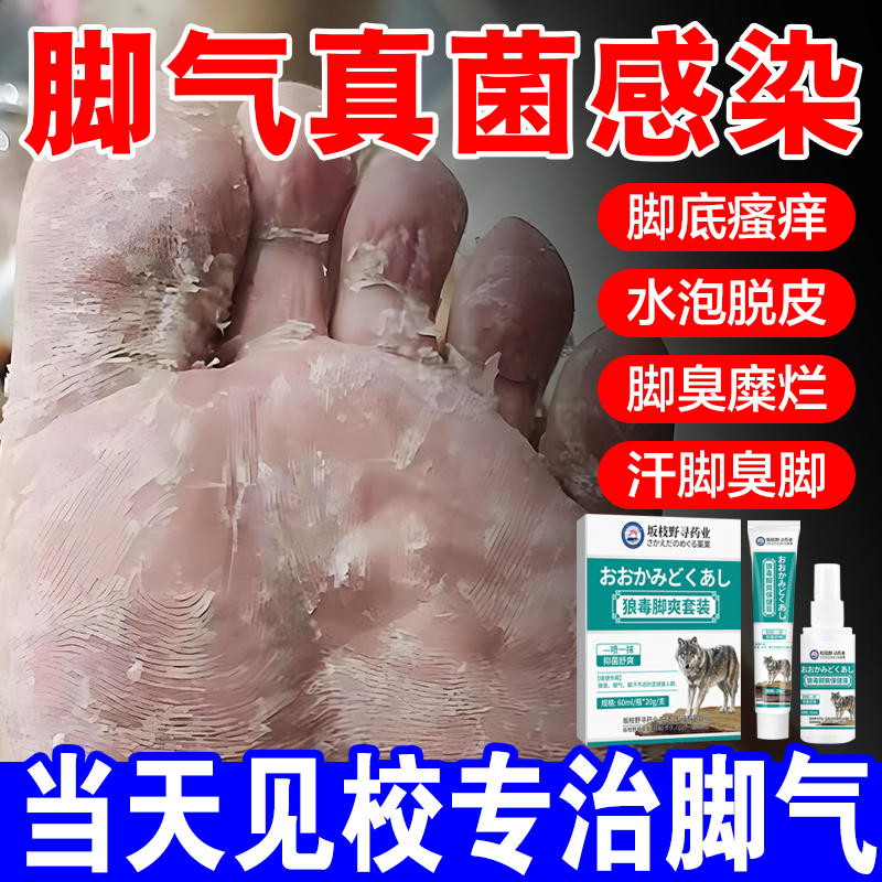 狼毒脚气喷雾止脱皮痒去真菌感染专用除臭脚出汗糜烂脚丫脚趾缝根