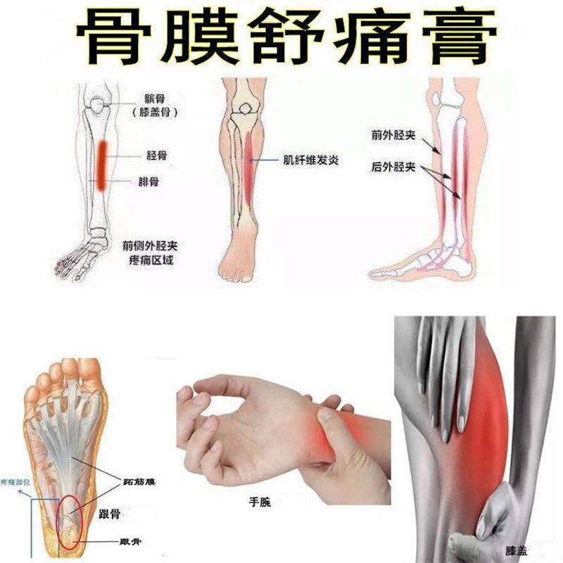 骨膜舒痛膏胫骨疲劳q性膝盖手腕骨膜贴胫腓骨小腿疼痛黑膏贴