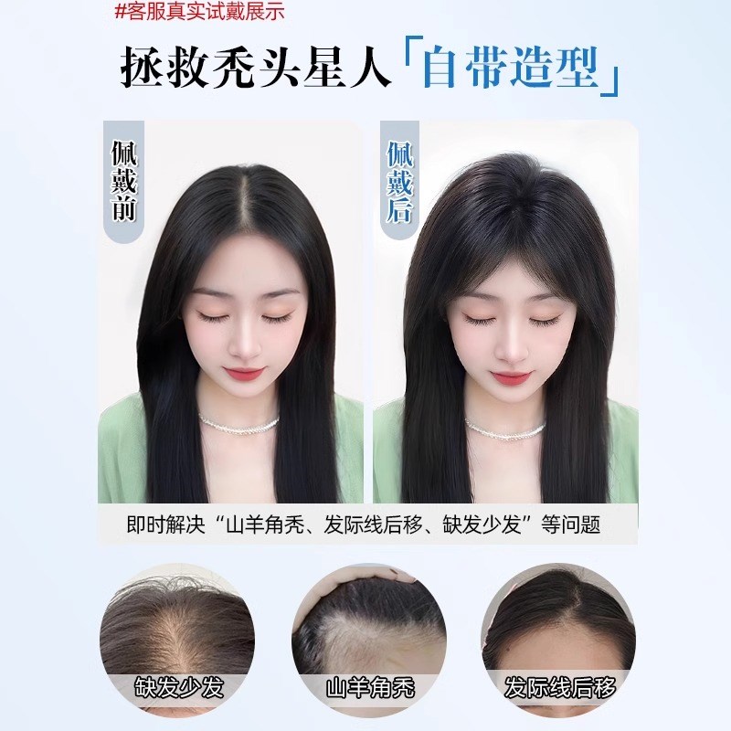 刘海假发女片头顶补发蓬松真发遮白发高颅顶增发量秋冬新款假刘海