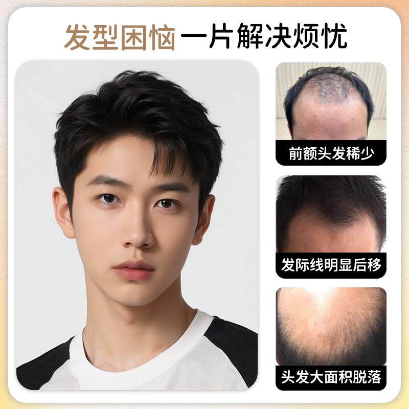 男士假发短发真发无痕隐形短发造型蓬松时尚男假发头顶脱发补发片