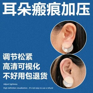 耳朵瘢痕耳夹可调压力式耳垂防止增生夹子透明压克力耳朵压力夹