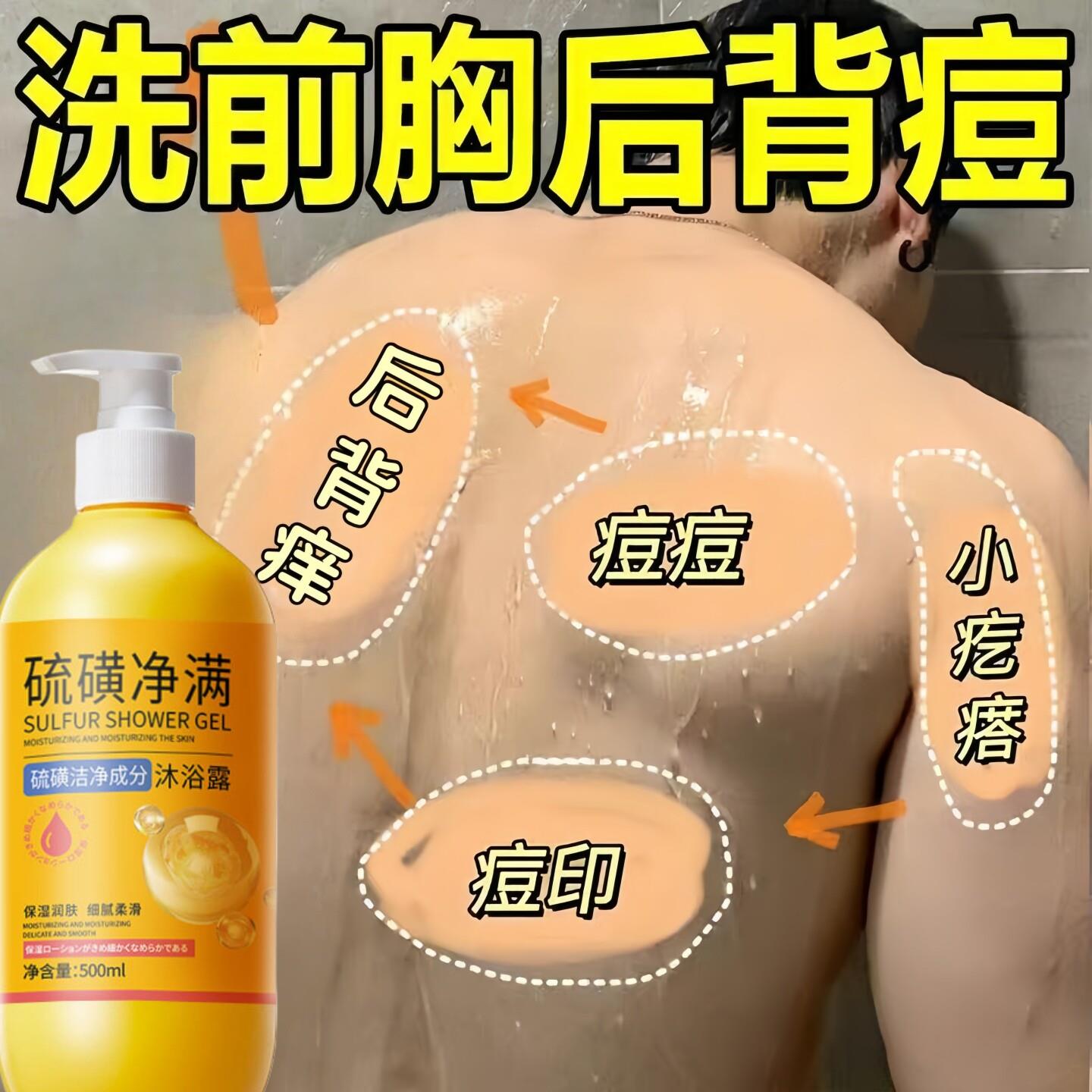 硫磺沐浴露除螨祛痘痒后背前胸清爽控油净肤沐浴液夏季男女士正品