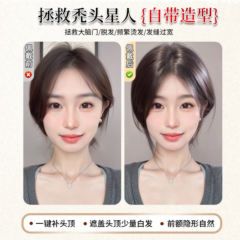 假发女片头顶补发蓬松真发高颅顶增发量无痕遮白发八字刘海假发片