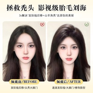 胎毛刘海假发片女头顶真发自然轻薄蓬松高颅顶隐形前额鬓角补发片