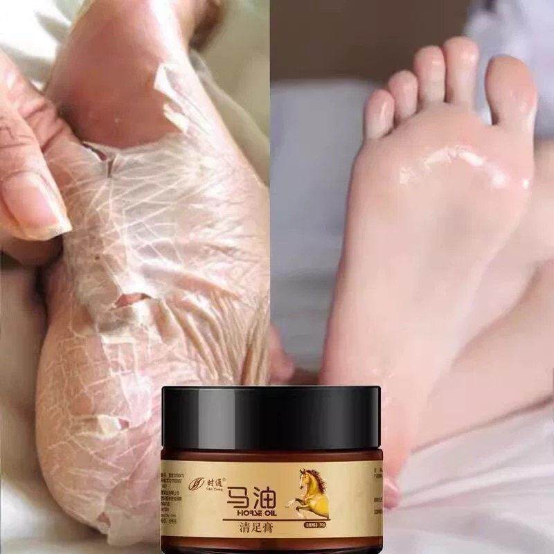 买一送一 小红书推荐~马油膏脚后跟防干裂脱皮皴补水保湿足霜