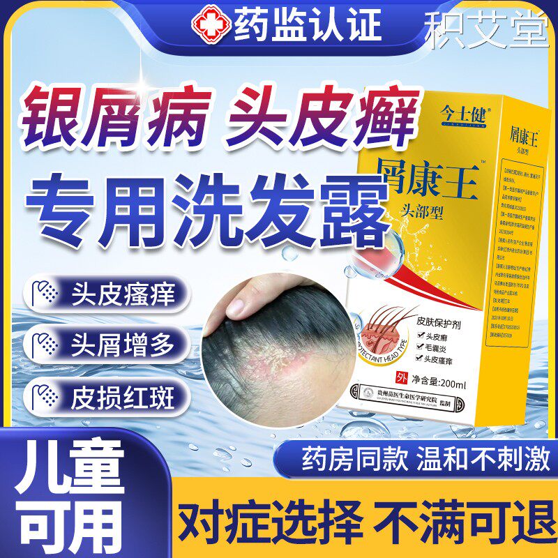 头皮癣药膏真菌感染藓牛皮银屑病癣专用洗发水红肿鳞屑去红斑瘙痒