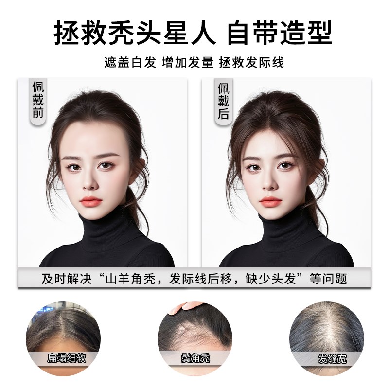 假发女片头顶全真发自然前额蓬松高颅顶增发遮白发轻薄无痕假发片