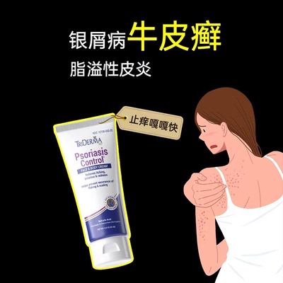 美国银屑病牛皮癣脂溢性皮炎膏缓解皮肤瘙痒刺激死皮红肿脱屑鳞屑