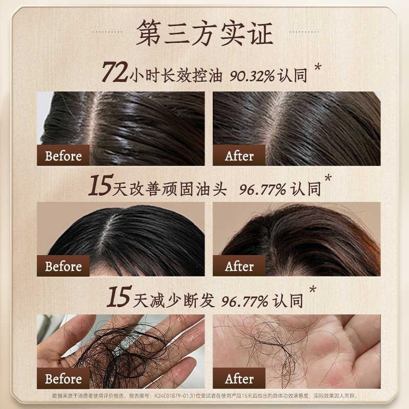 长发小寨淘米水洗发水官方正品旗舰红瑶养发国颐堂防脱滋养精华液