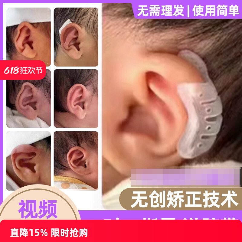婴儿耳廓矫正器宝朵纠新生