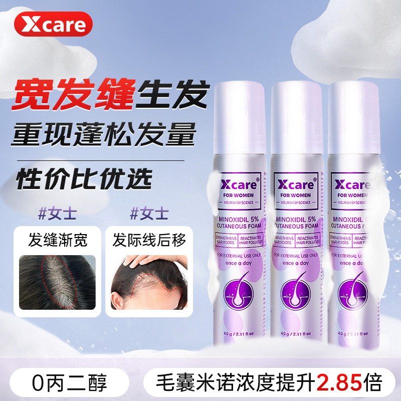 3盒】Xcare英国米诺地尔泡沫剂5%女士生发液防脱生发泡沫剂旗舰店