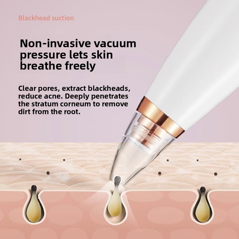 吸黑头神器美容仪器脸部小气泡黑头粉刺热敷毛孔清洁仪吸出器修A1