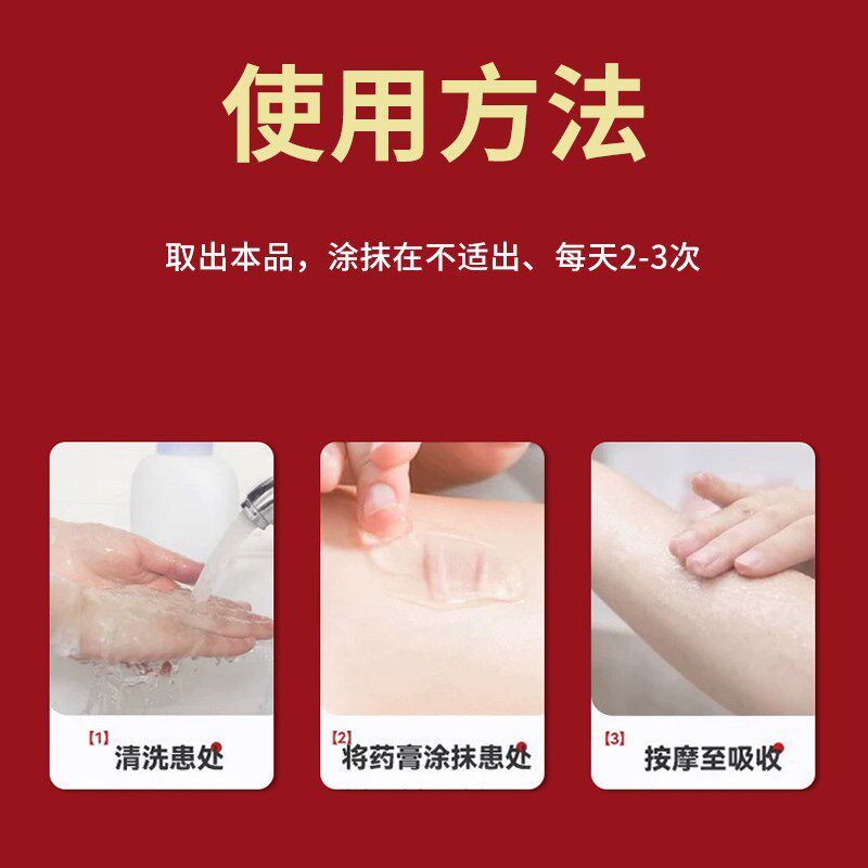 成人脐疝肚脐鼓包脐部肿块突出中老年腹沟疝小肠疝腹外疝膏