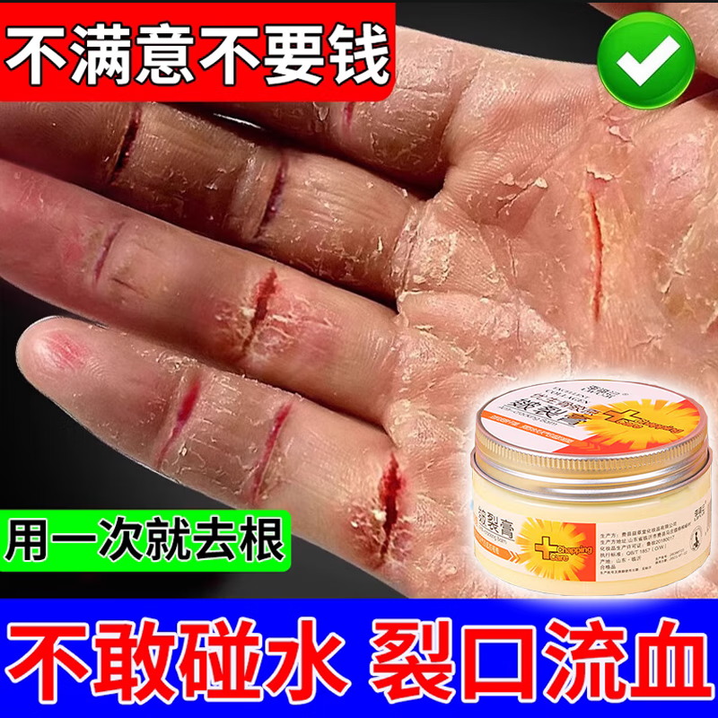 治手裂的药膏裂口子干燥粗糙爆干皮手指干裂修复霜皲裂痒愈合神器