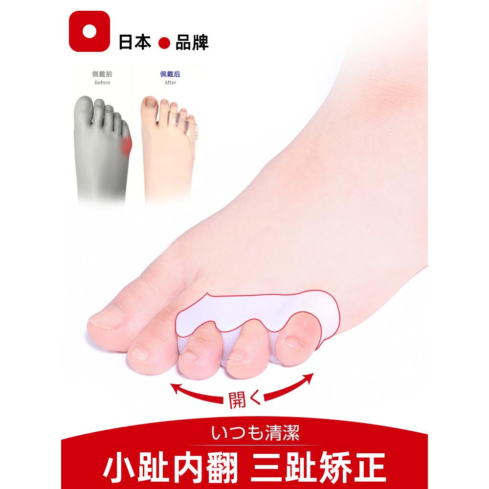 日本脚趾内外翻矫正器小拇指分离硅胶分趾器大母趾头足纠正可穿鞋