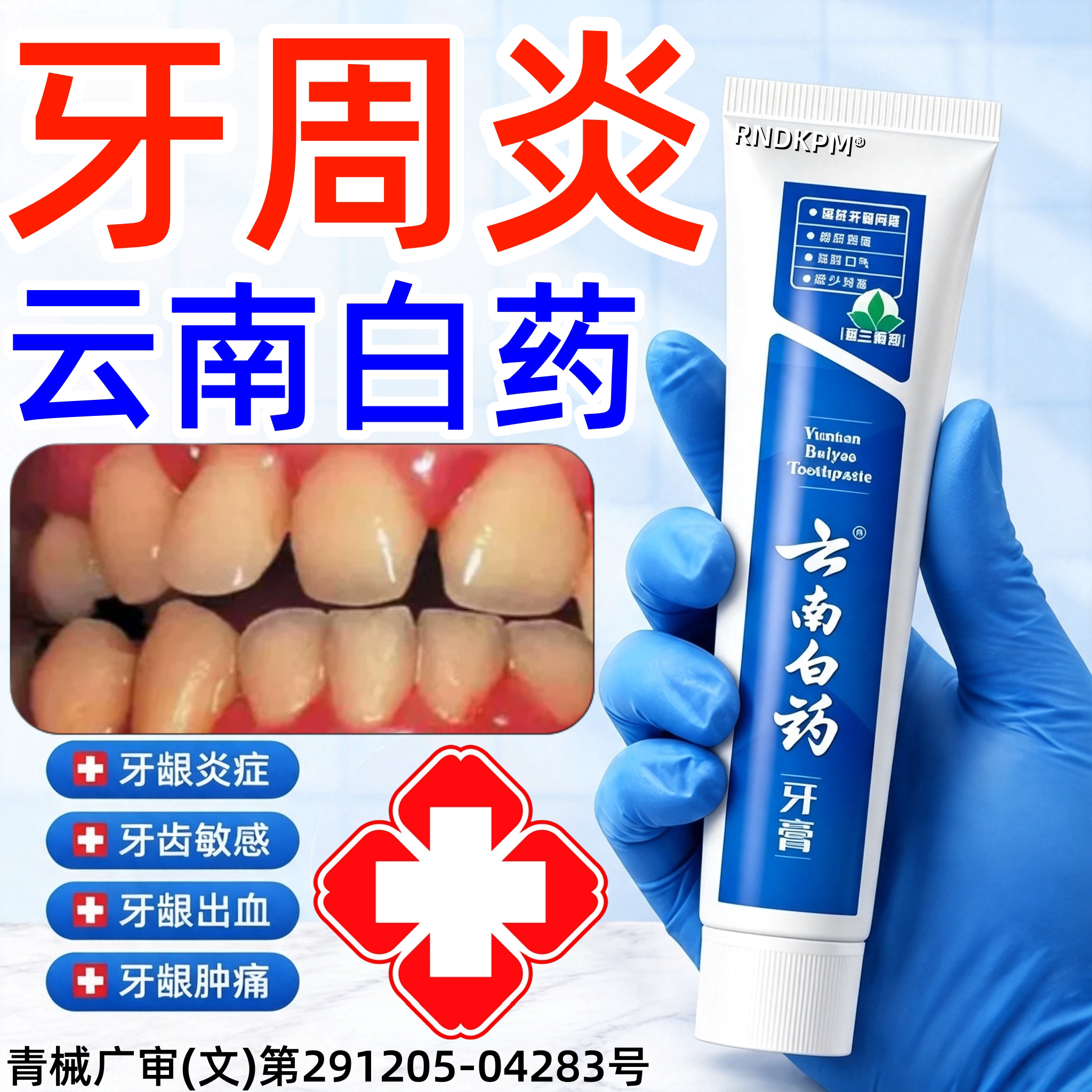 云南白药牙膏官方旗舰店正品治I牙周炎口腔牙龈炎牙敏感出萎血pp