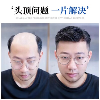 美禾假发男士真人发丝头顶脱发手织补发块中年男式毛寸补发片