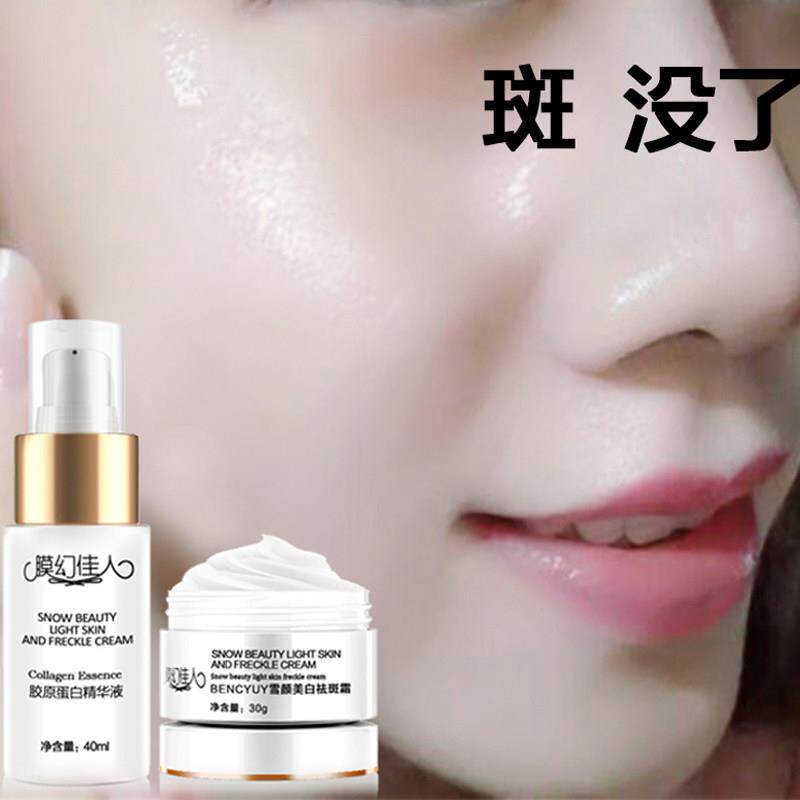 正品霜去班雀斑晒斑黄褐斑脸部色斑套装