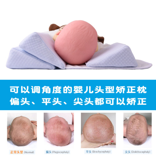婴儿定型枕宝宝纠正头型枕新生儿侧睡枕矫正防偏头尖V头扁平头0-1