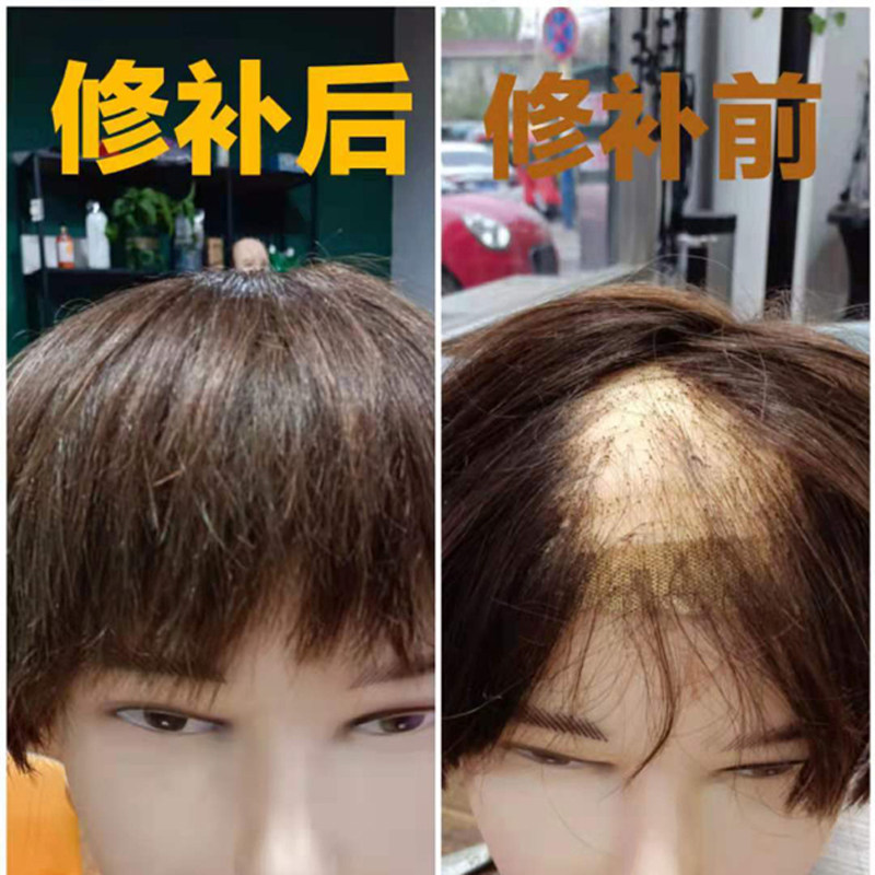 假发片男b短发 全真人发 头顶补发片 修补染色修剪
