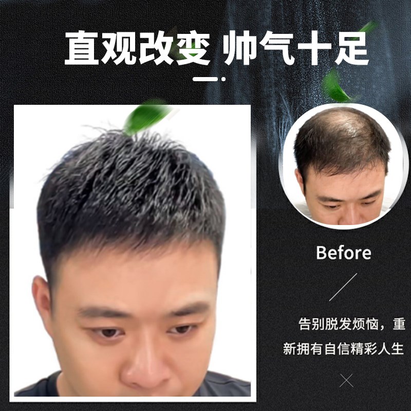 假发片真人发丝定制无痕短直发自然生物头皮补发男生毛寸头顶补发