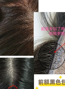 顺心假发真人发丝头顶补发片遮挡白发少染发女神补发片